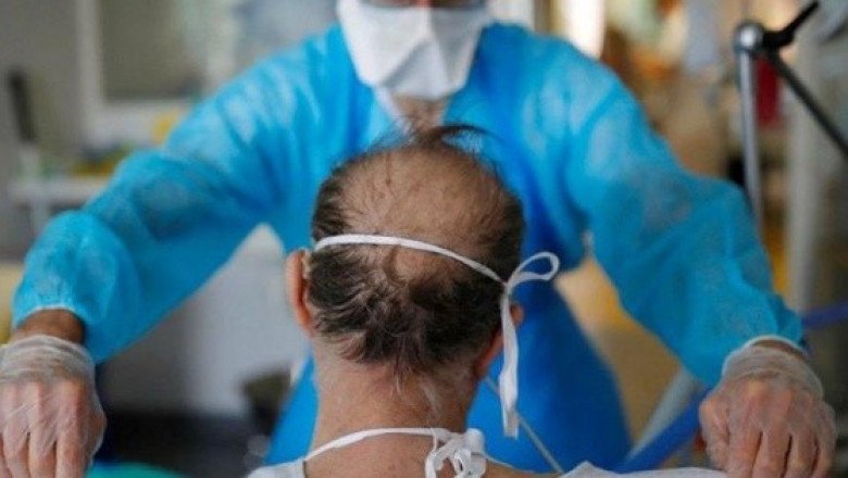 Médicos advierten de efectos que el COVID-19 puede tener en el cerebro