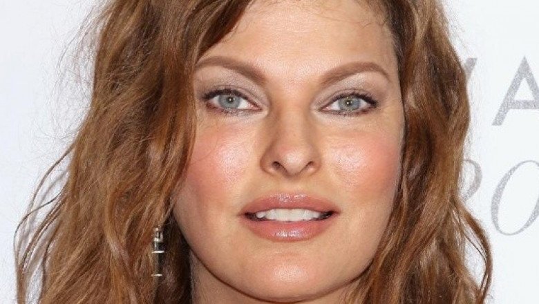 ¿Qué es la hiperplasia adiposa paradójica (HAP) que sufre Linda Evangelista?