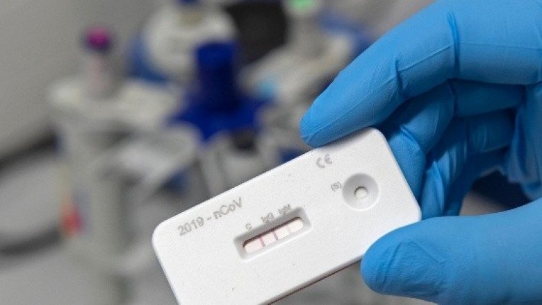 Surge venta de pruebas "patito" de COVID-19 en redes sociales