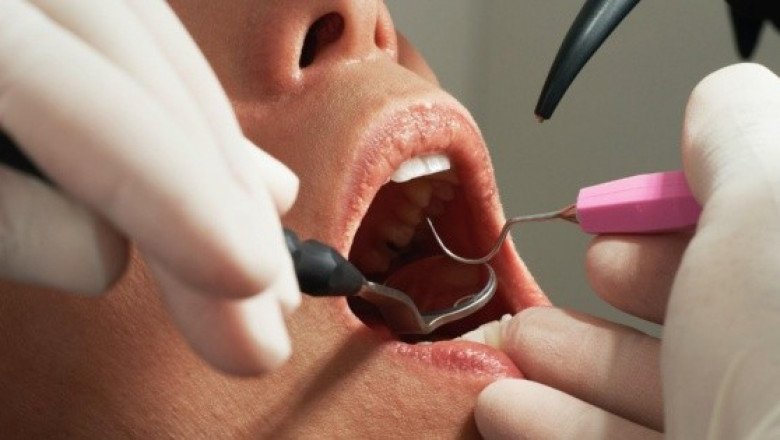 ¡Escalofriante! Va al dentista y termina con pieza de taladro en un pulmón