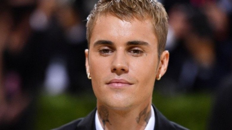 Justin Bieber revela que tiene la mitad de su cara paralizada (VIDEO)