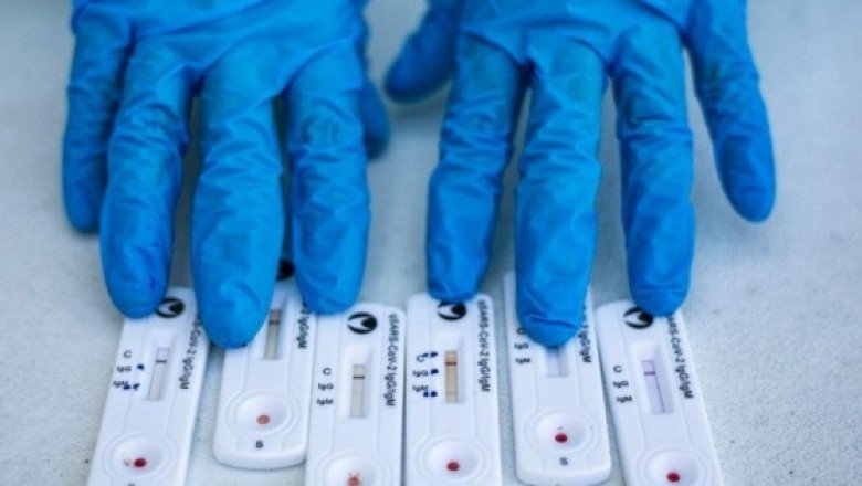 China sostiene que siempre ha sido "abierta y transparente" sobre el COVID