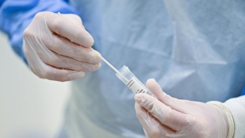 ¡Alerta! La OMS confirma un caso del virus MERS en los Emiratos Árabes