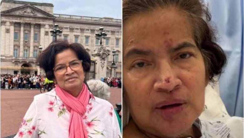 Quería conocer a la Virgen de Fátima, viajó y terminó amputada de manos y piernas por una terrible bacteria