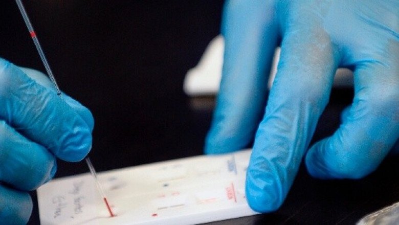 ¿Qué es la "Enfermedad X" que sería más letal que el COVID?