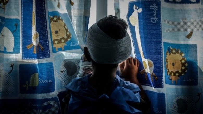 ¿Cuáles son los tipos de cáncer pediátrico más comunes en México?