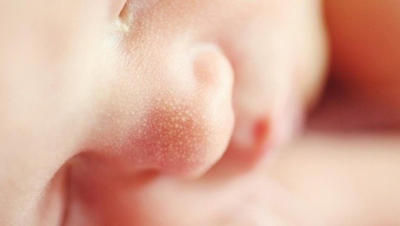 Pediatras de EUA anulan recomendación sobre que las madres con VIH no amamanten