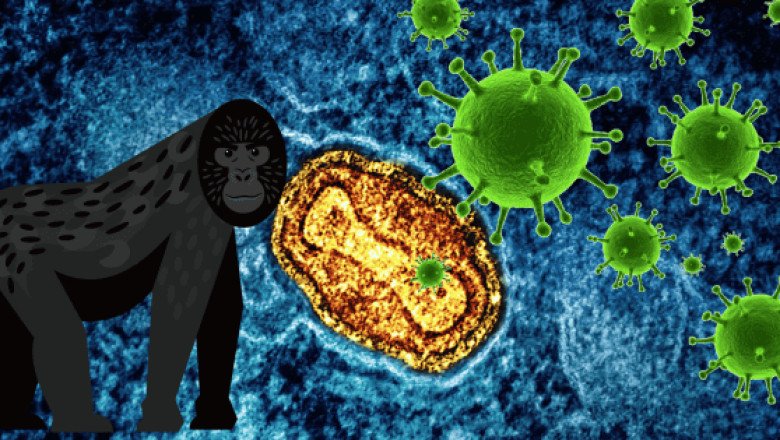 ¿Por qué se le decía antes viruela del mono al mpox?