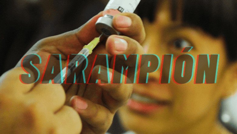 ¿Cuántos casos de sarampión en México hay y dónde se ubican?