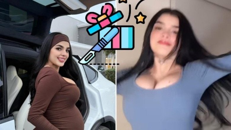 Karely Ruiz regalará cirugía estética a través de redes sociales