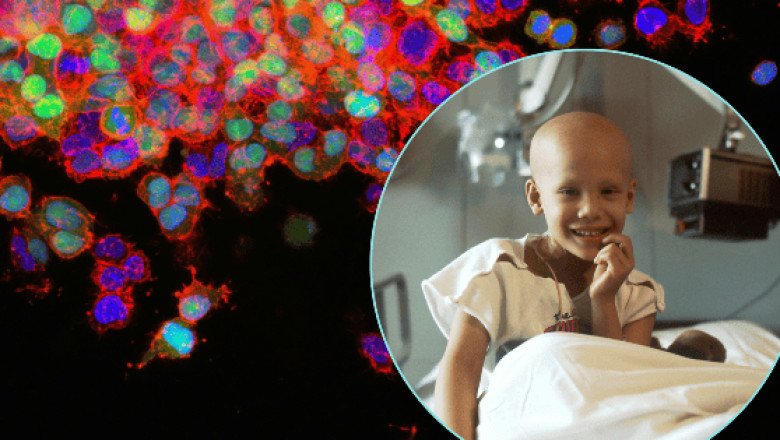 Cáncer infantil es la primera causa de mortalidad en México