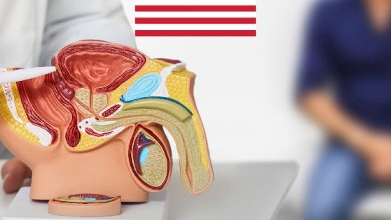 Tasas de cáncer de próstata han aumentado durante la última década en Estados Unidos