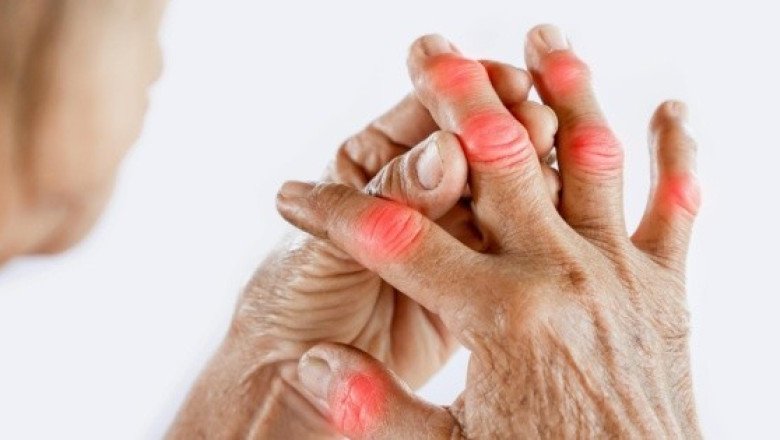 Osteoartritis afecta a seis de cada 10 mexicanos y empeora con el frío