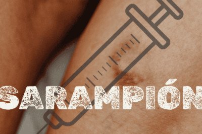 Brote de sarampión en México: dónde aplicarle la vacuna de forma gratuita