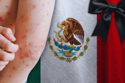 ¿Cuántos muertos van en México por sarampión hasta HOY?